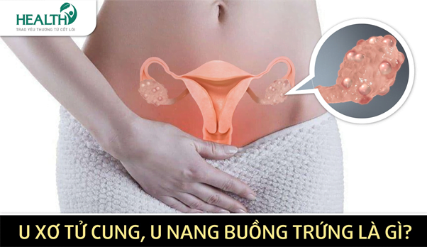 u-xo-u-nang